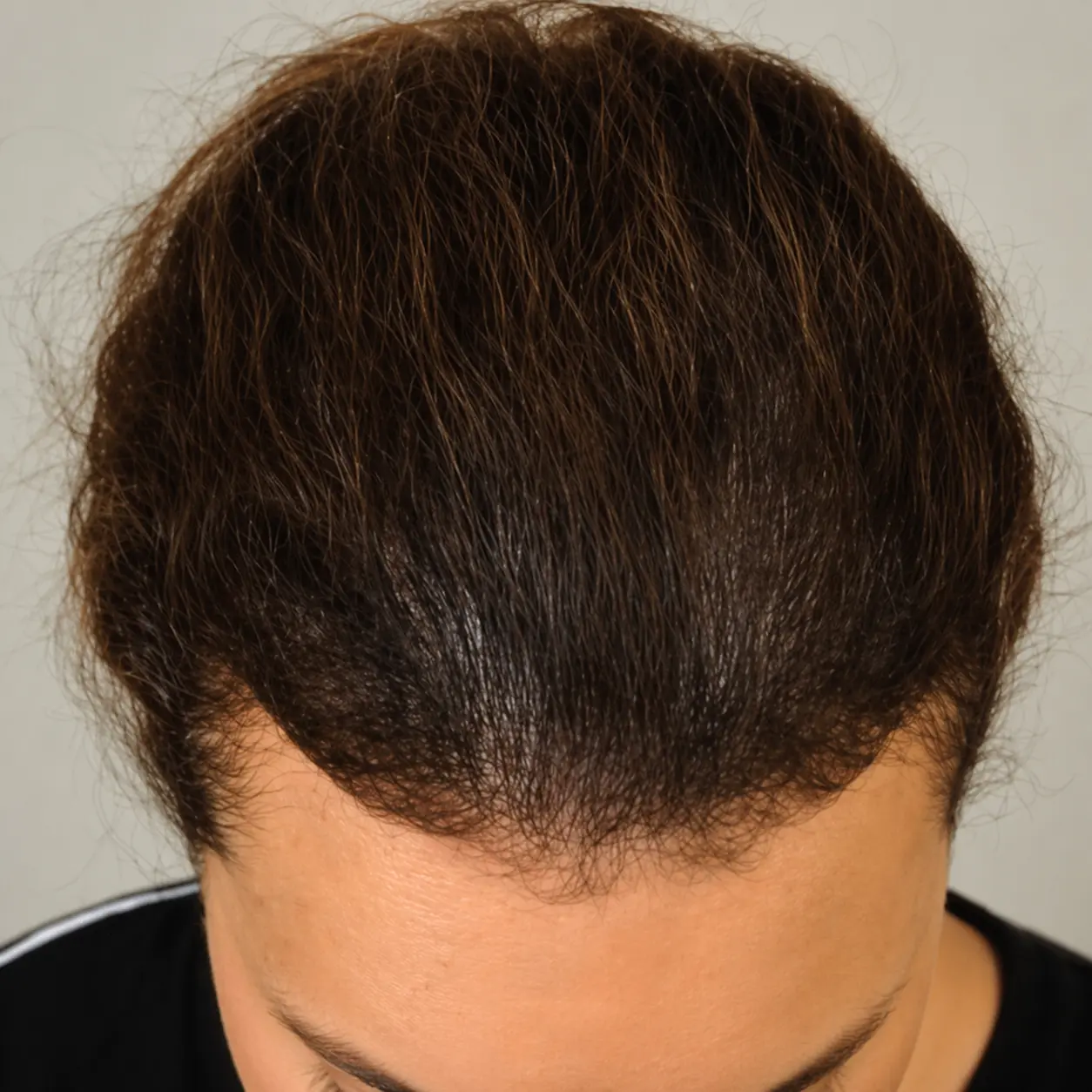 After
