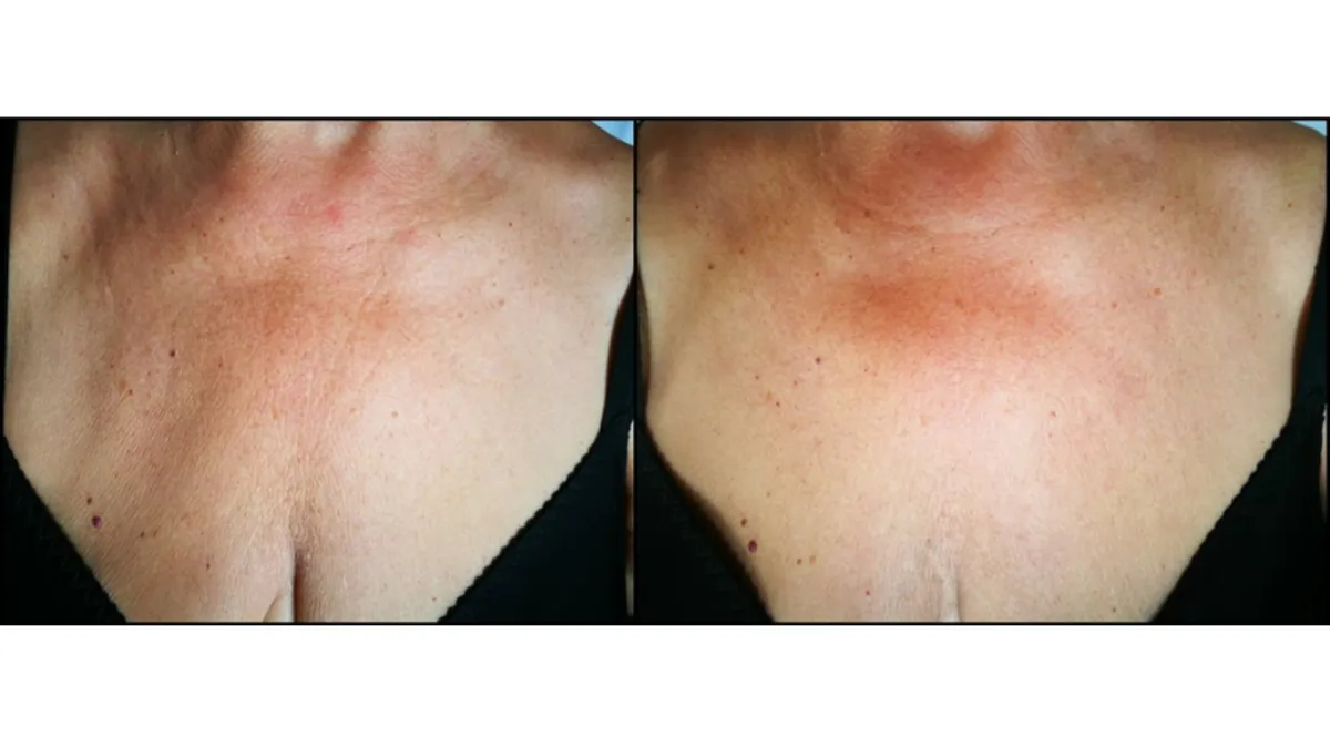 BioRePeel Results