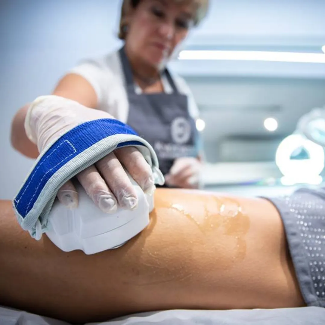 Shockwaves and Cryolipolysis Combination