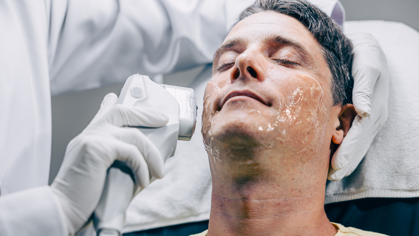 Male HIFU jawline sculpting and neck tightening treatment in Chelsea London