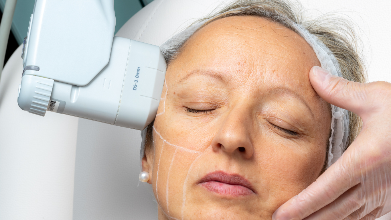 HIFU face and neck treatment lifting jawline at Knightsbridge clinic near Harrods