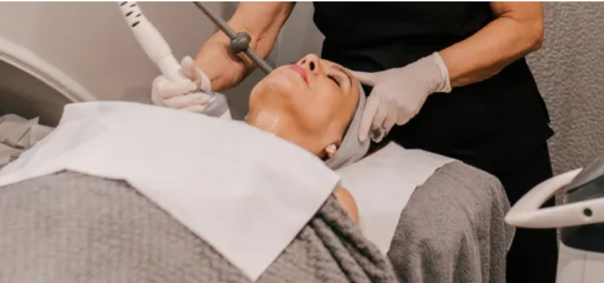 RF Microneedling Face Treatment