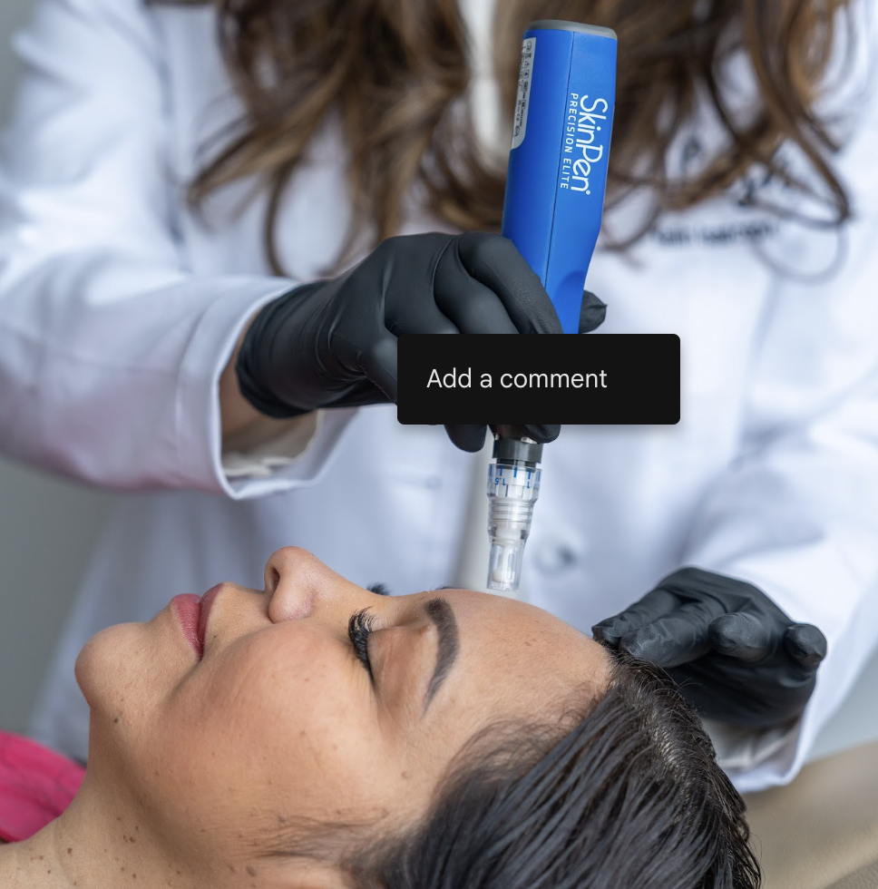 Microneedling