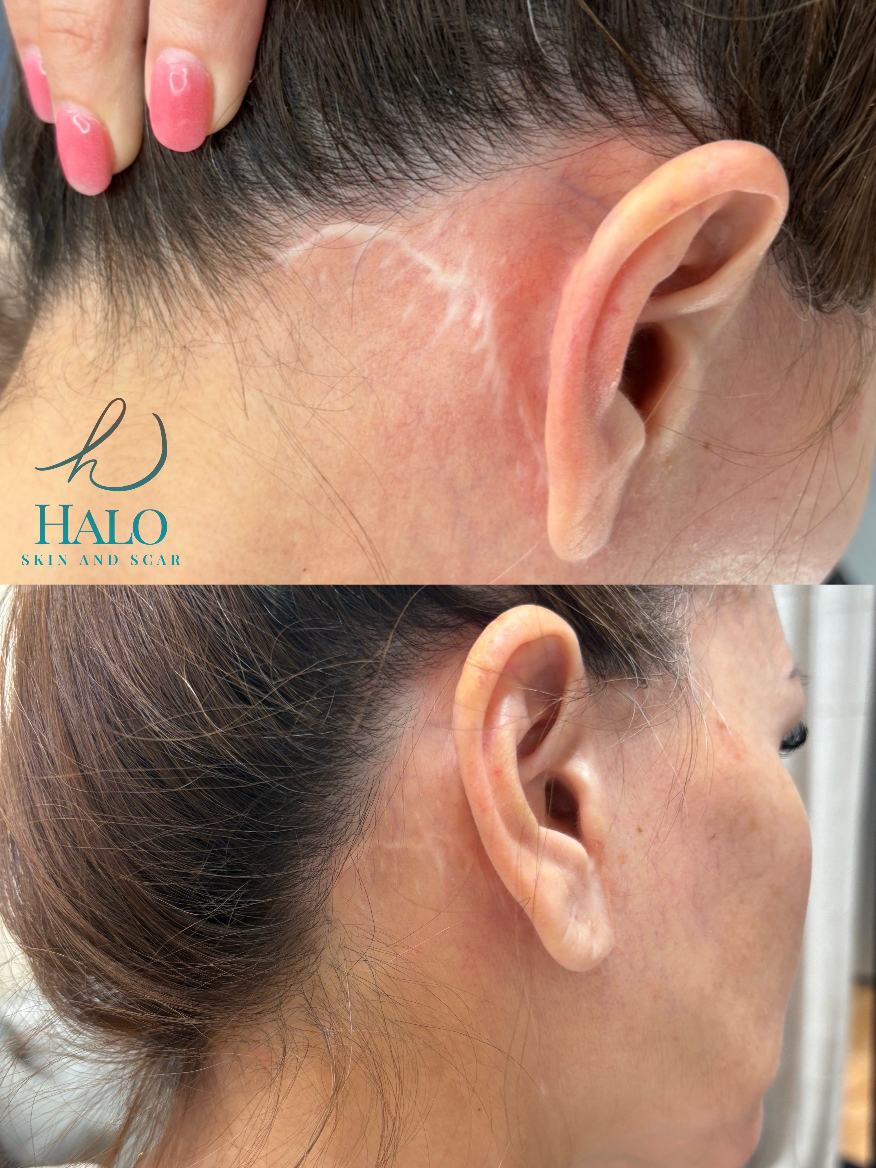 Before and After 1