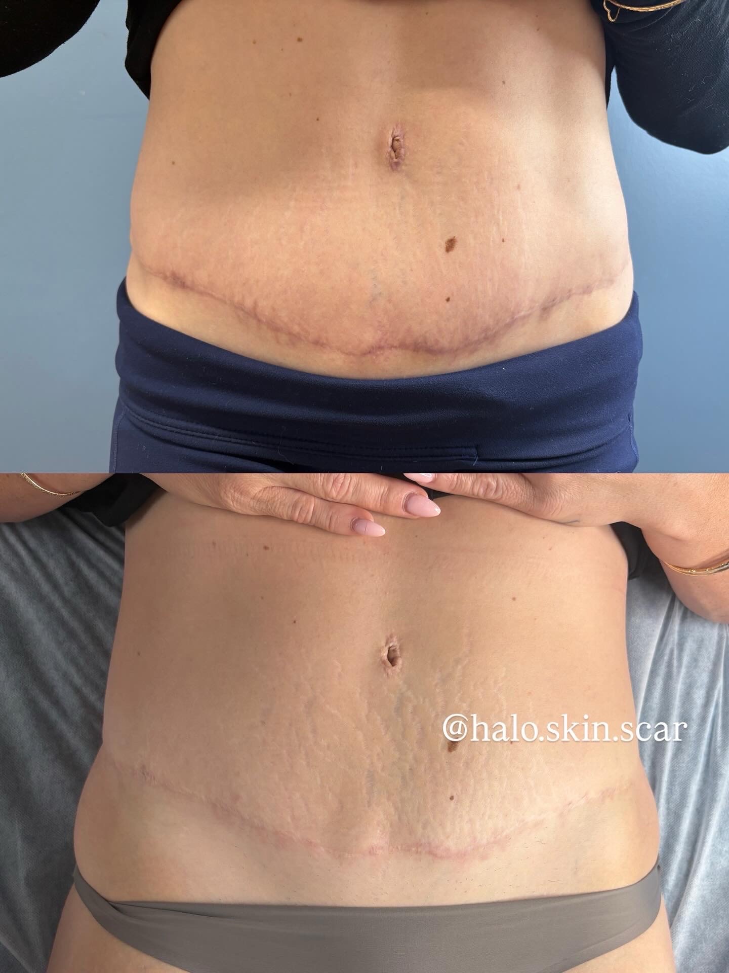 Before and After 4