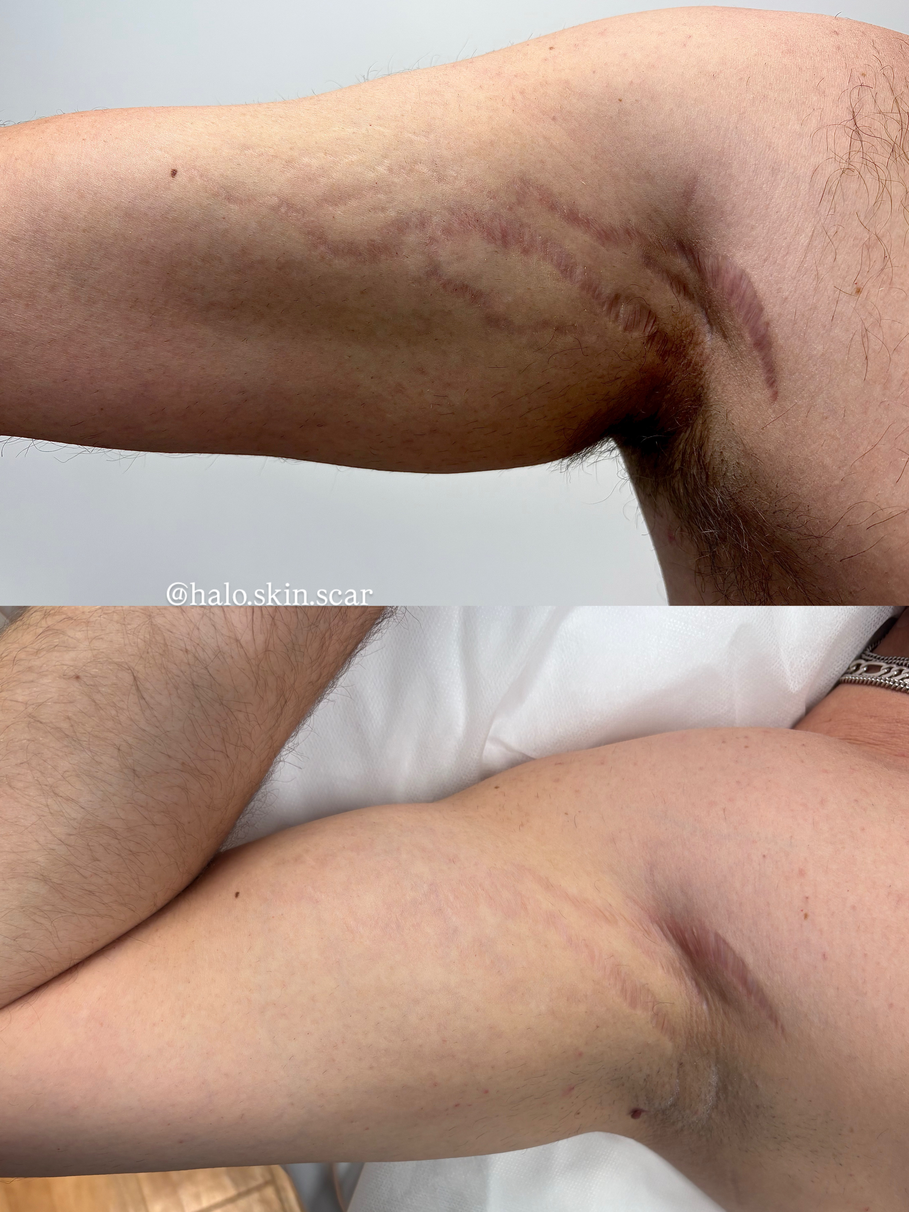 Before and After 3