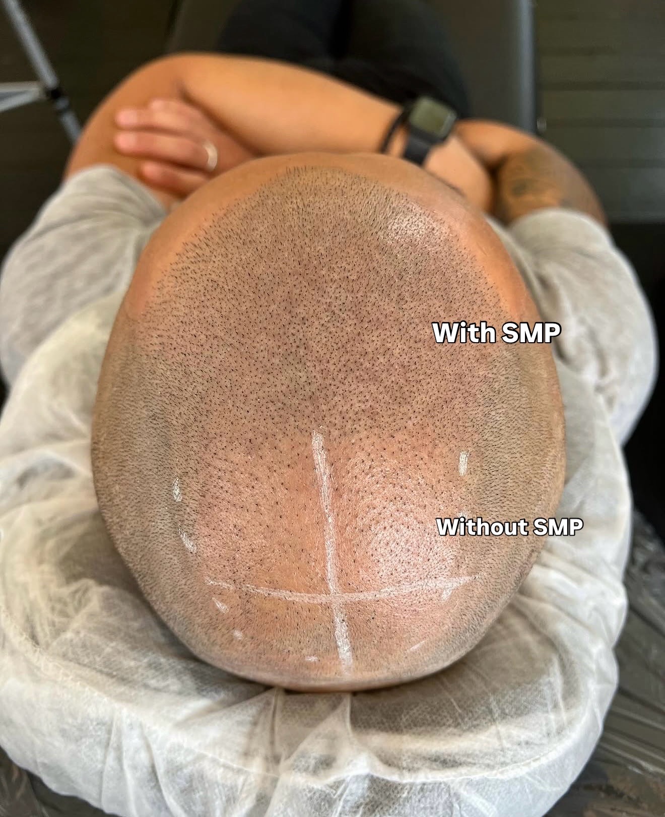 SMP Before and After