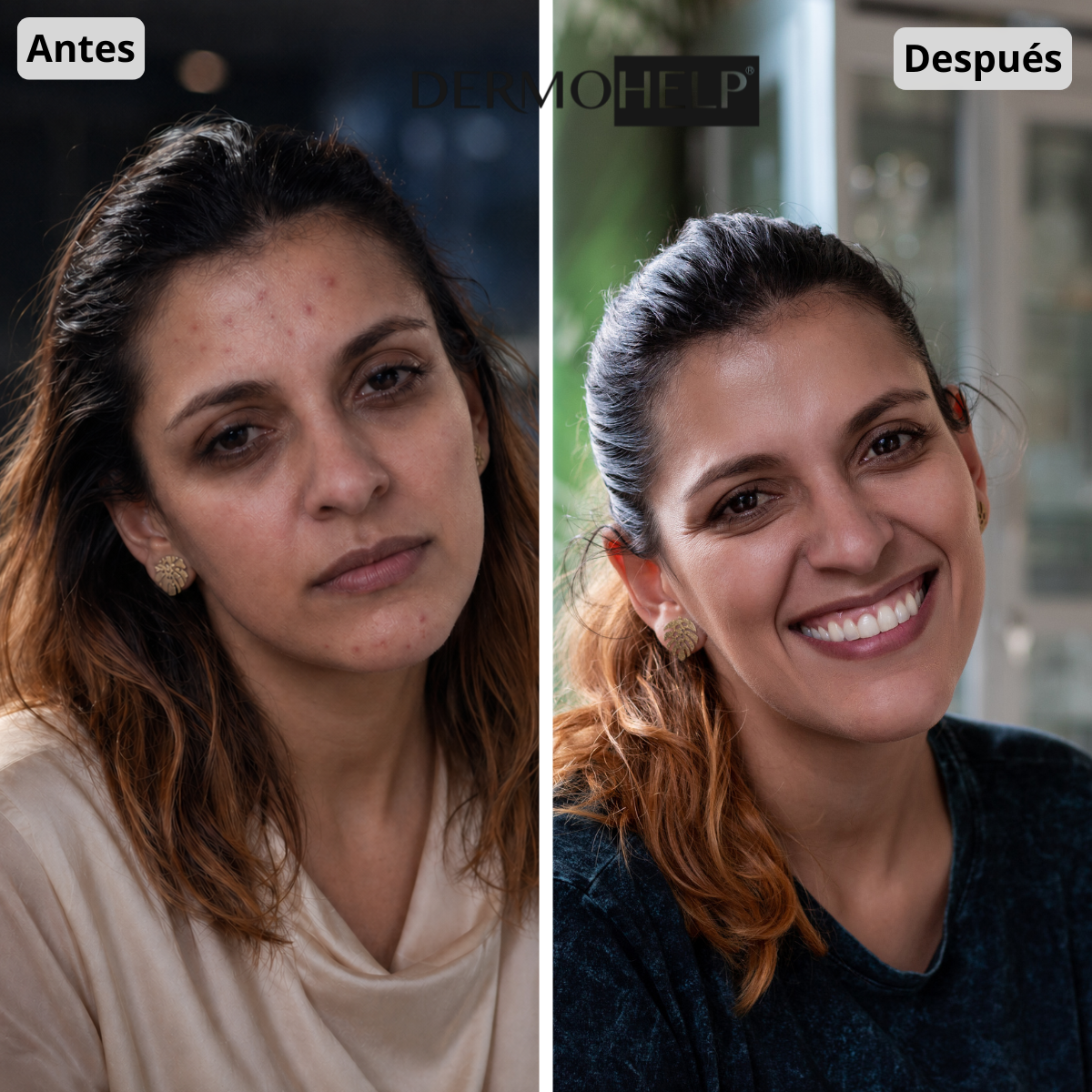 Antes y después de Sofía Vargas