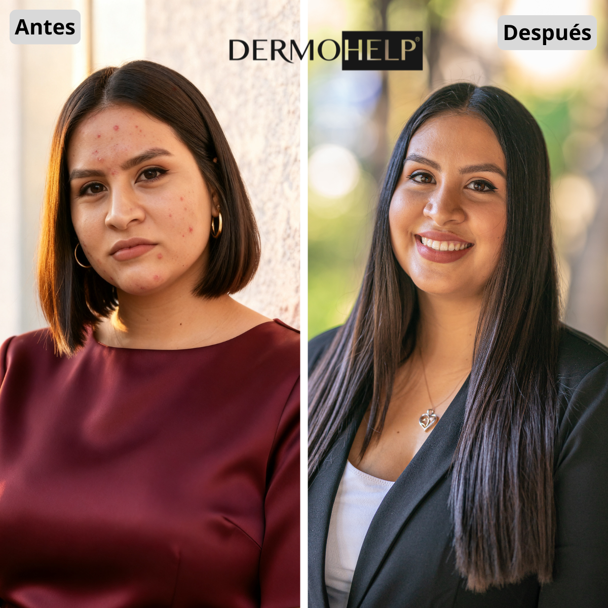 Antes y después de Valeria Rueda