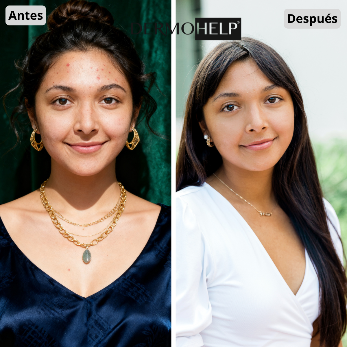Antes y después de Isabella Castro