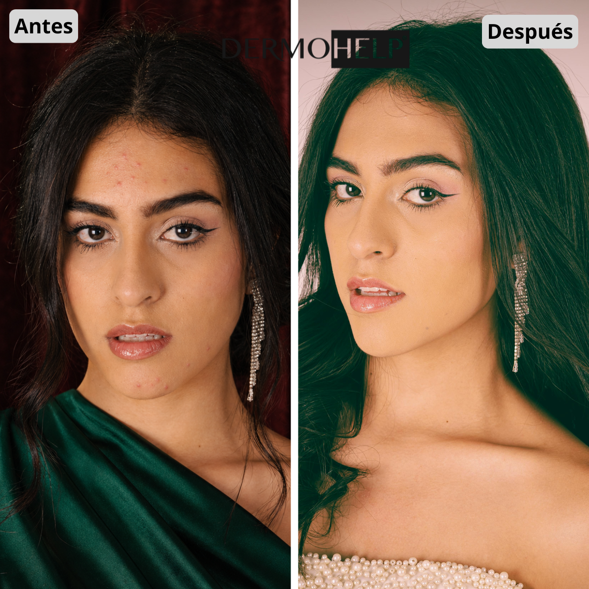 Antes y después de Juliana Restrepo