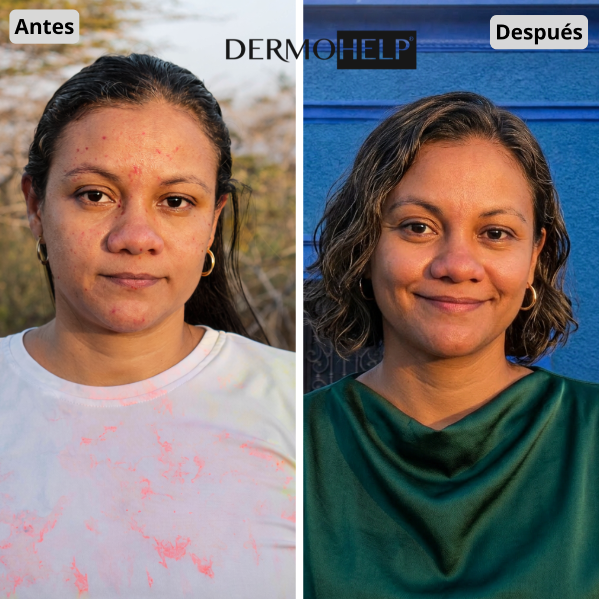 Antes y después de Claudia Moreno