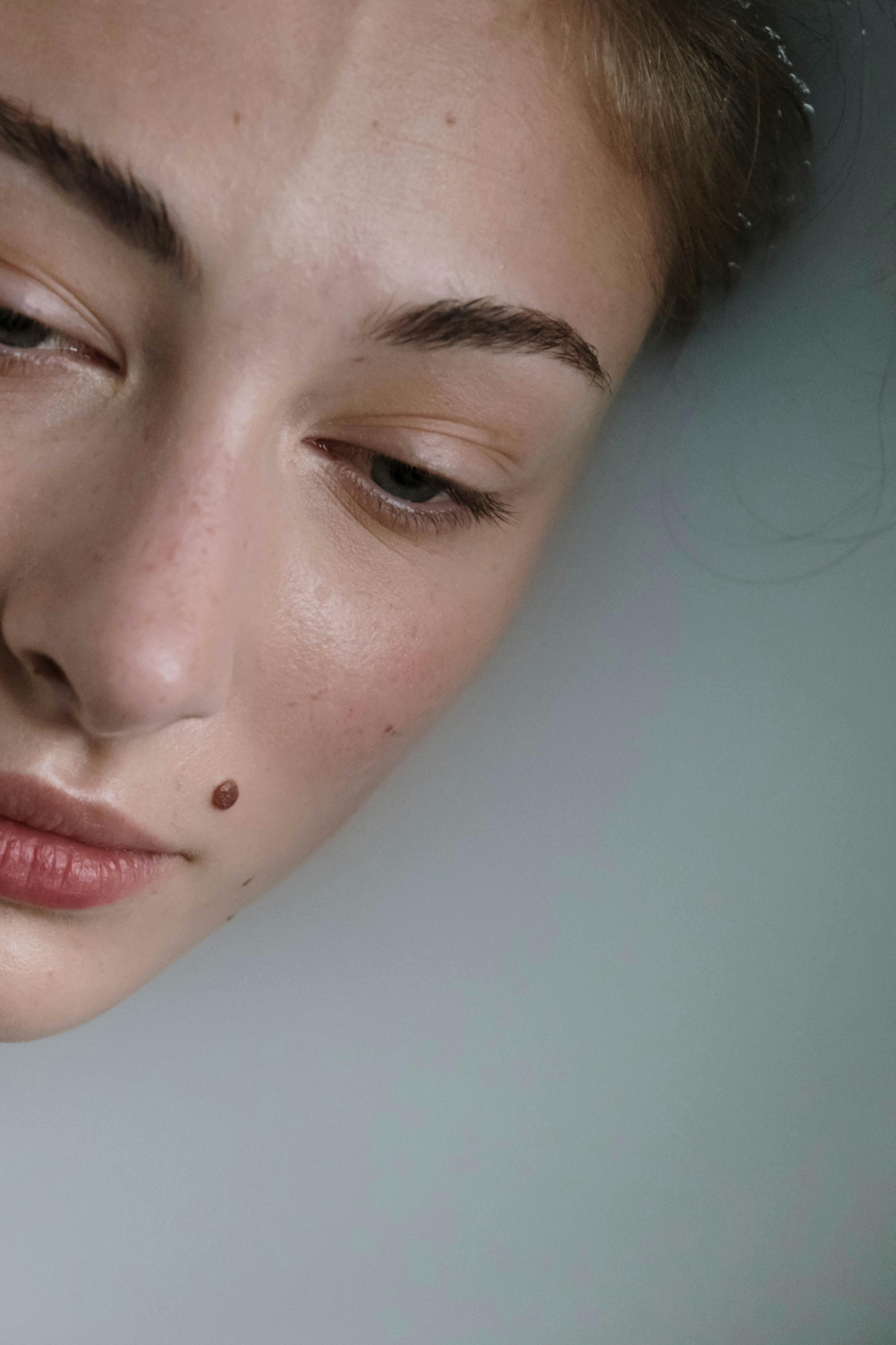 Mole Removal