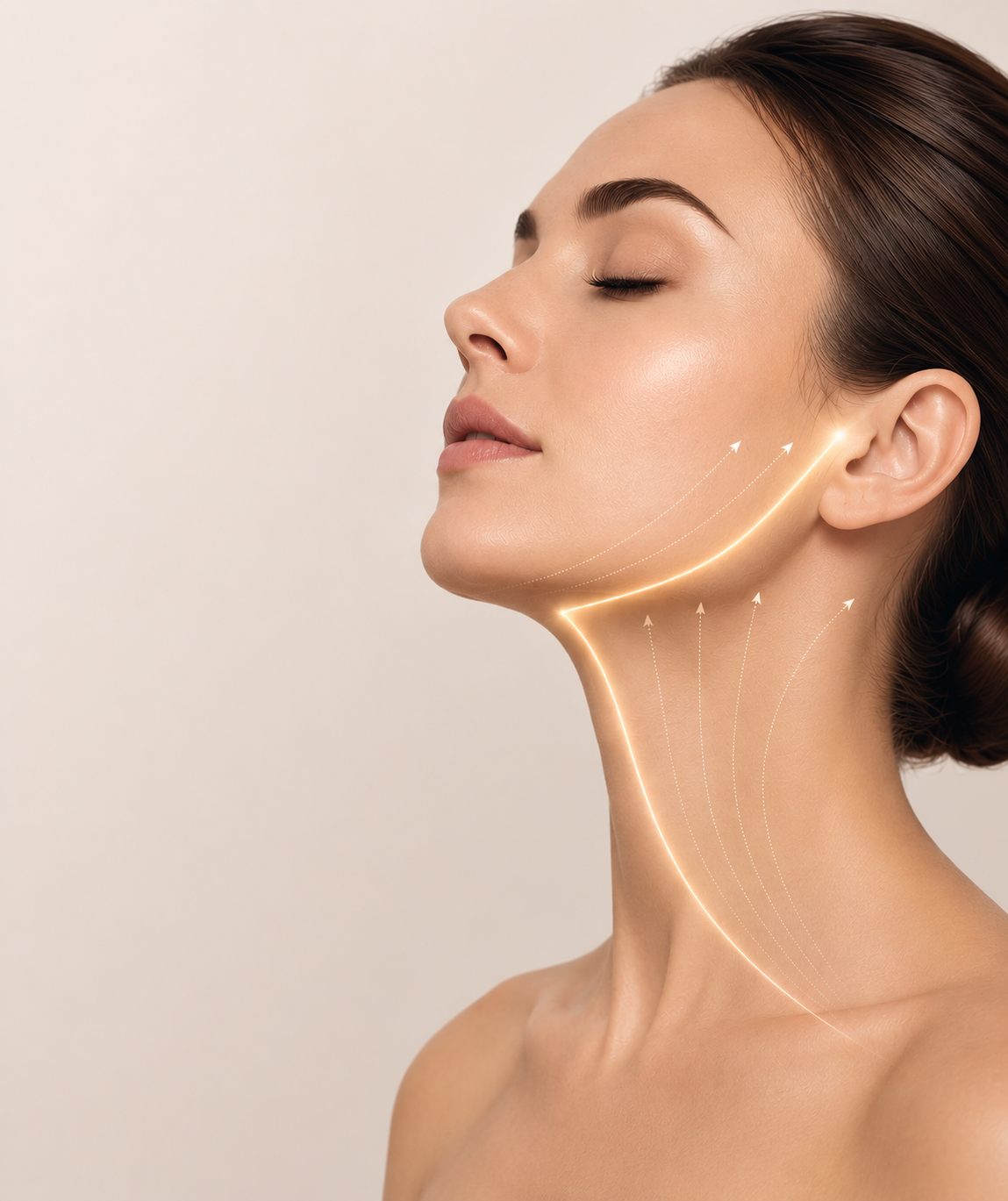 Endolift
