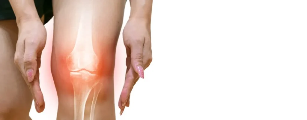 Osteoarthritis