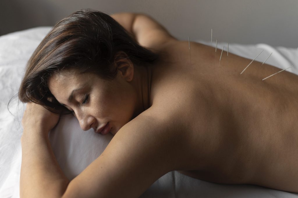 Acupuncture for Intellectual Disabilities