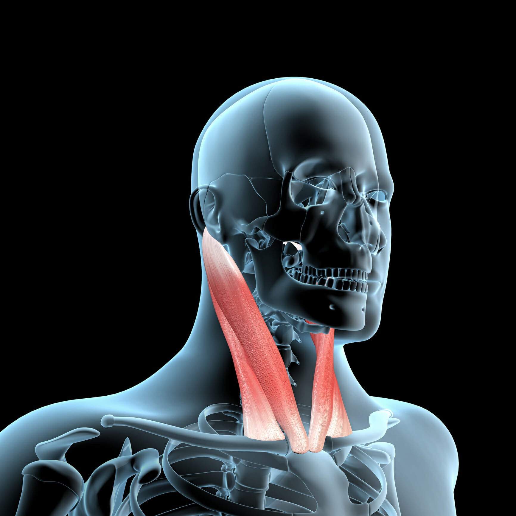 SCM Sternocleidomastoid