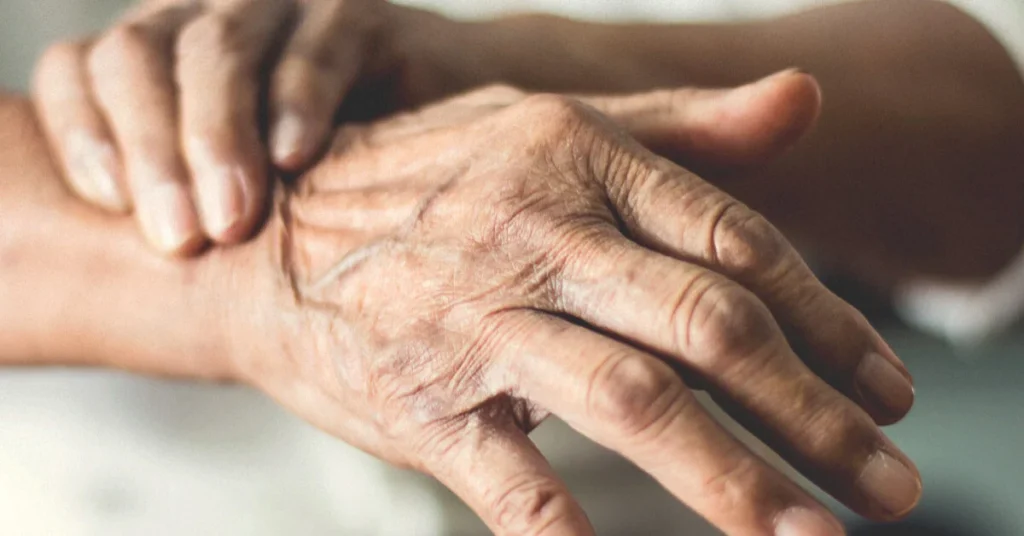 Parkinson’s Disease