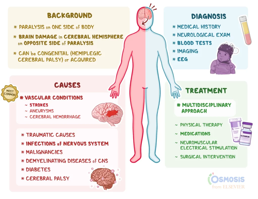 Hemiplegia