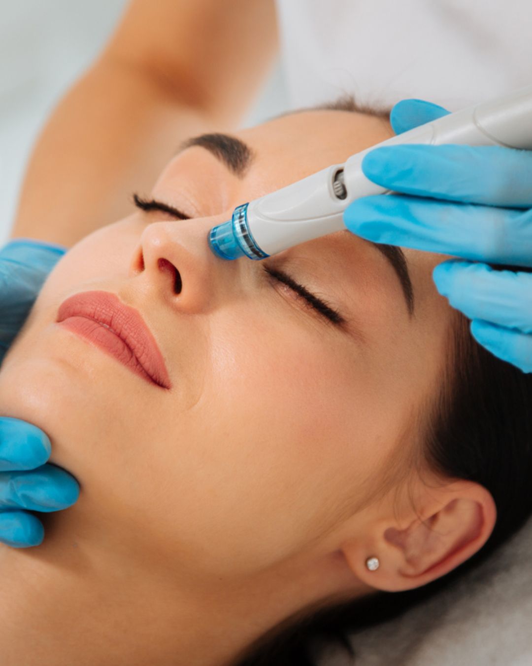 Skin Care Treatment