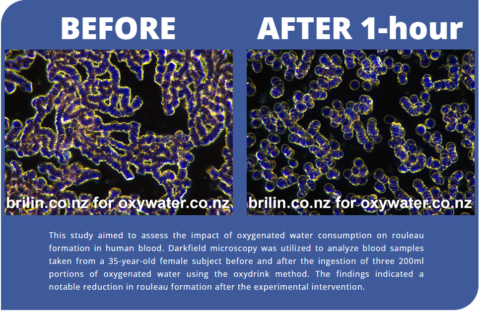Live Blood Analysis Before and After