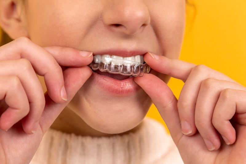 The Ultimate Guide to Reducing Dental No-Shows