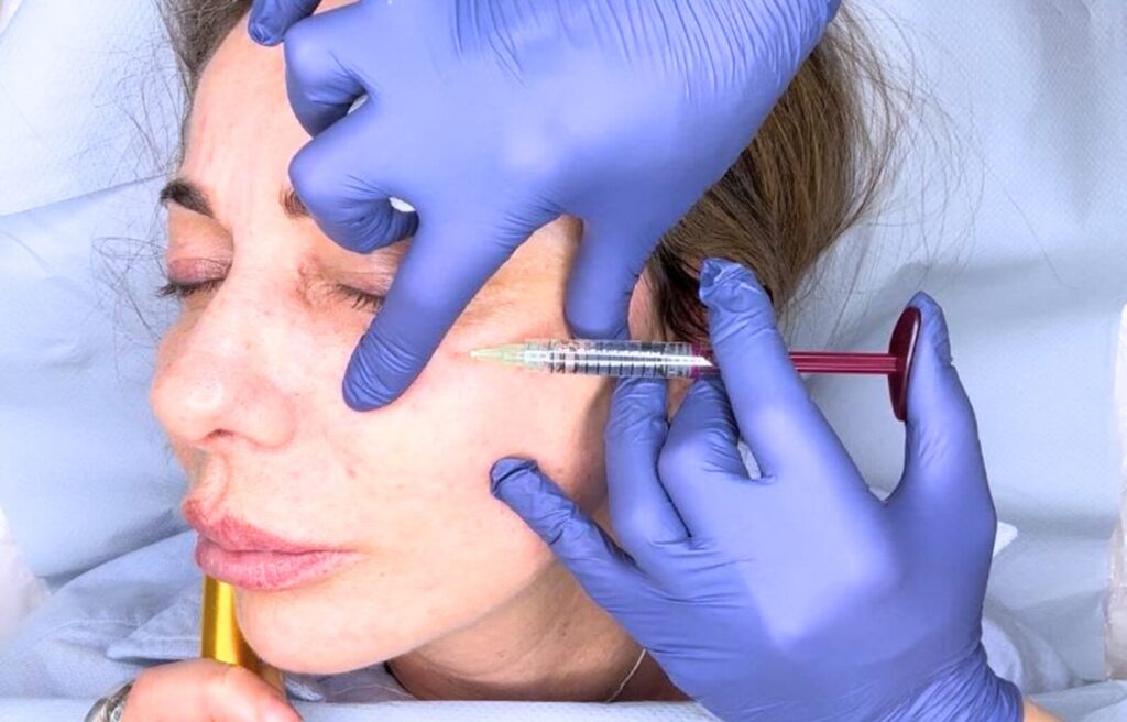 Best Treatments for Acne Scars in Cambridge: A Nurse's Guide