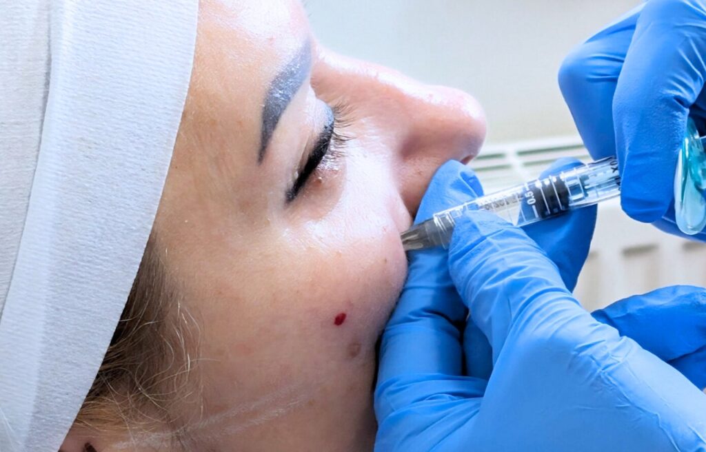 How to Prepare for Your First Aesthetic Appointment