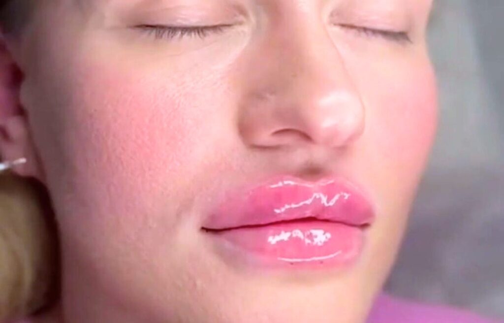 Clinical skin treatment precision result RB Medical Aesthetics