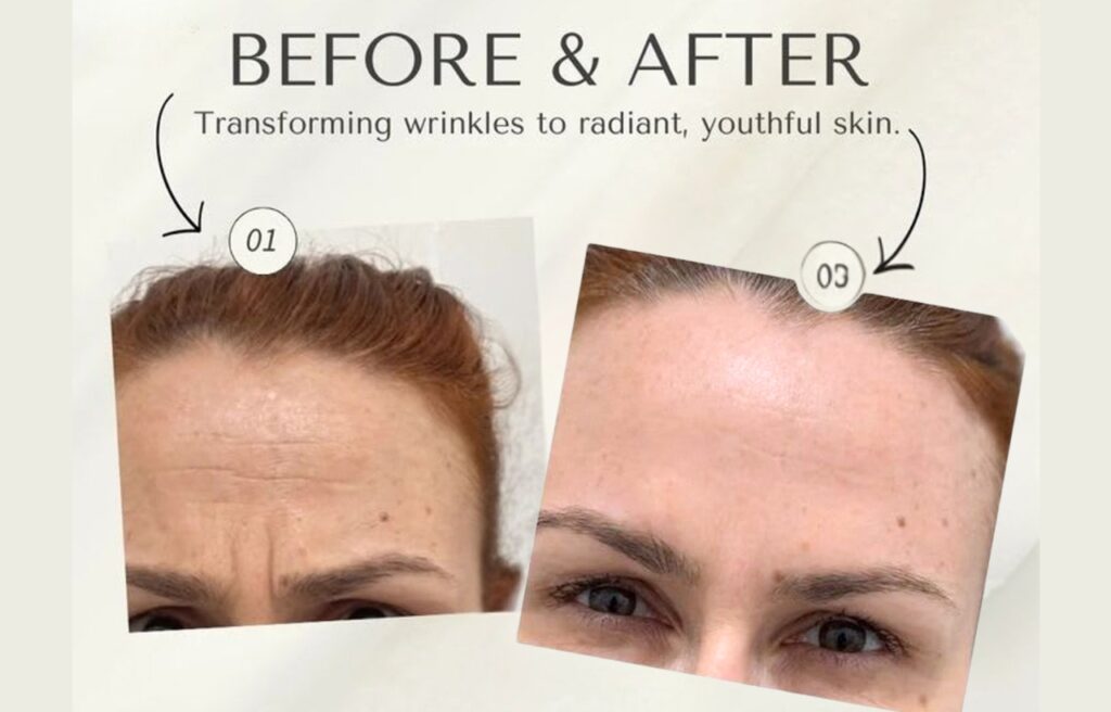 Why a Face-to-Face Consultation is Crucial in Aesthetics