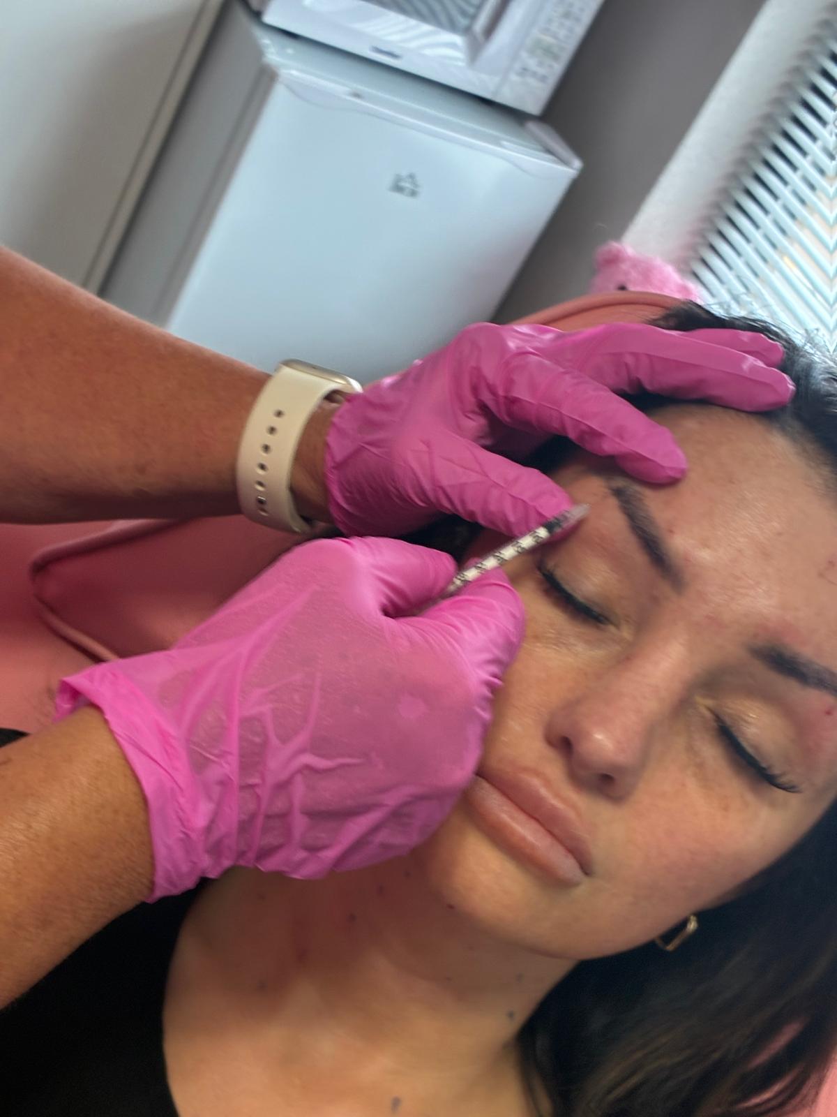 Brow Lift Treatment