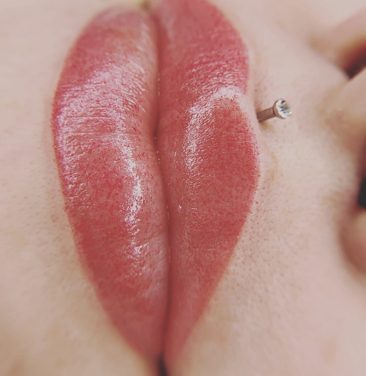 Close up of beautifully restored lips