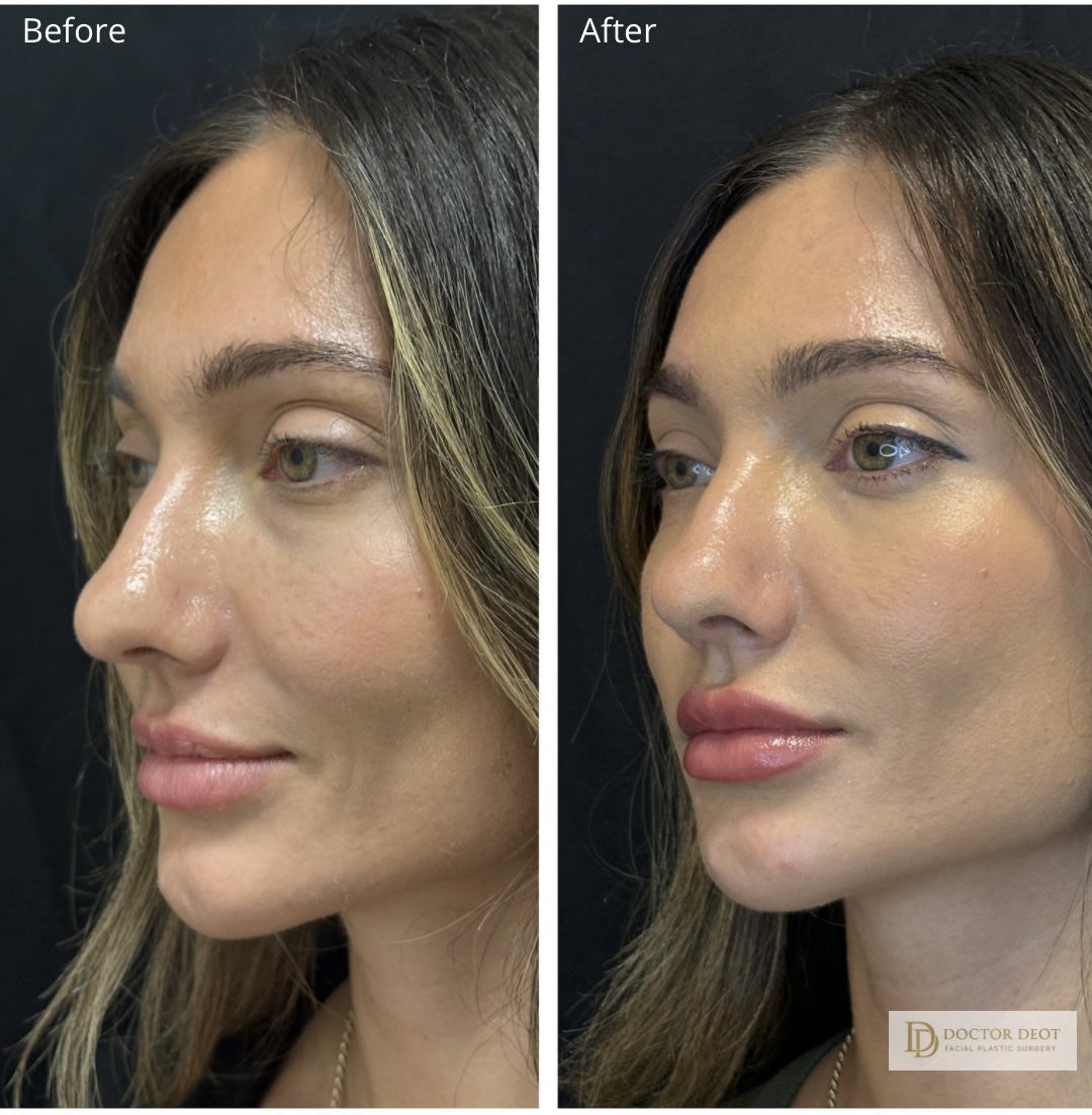 Skin Lesion Removal Before and After