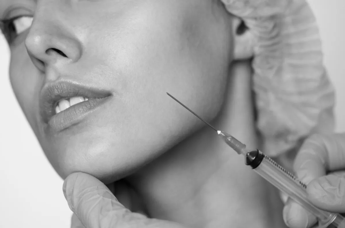 Profhilo Treatment