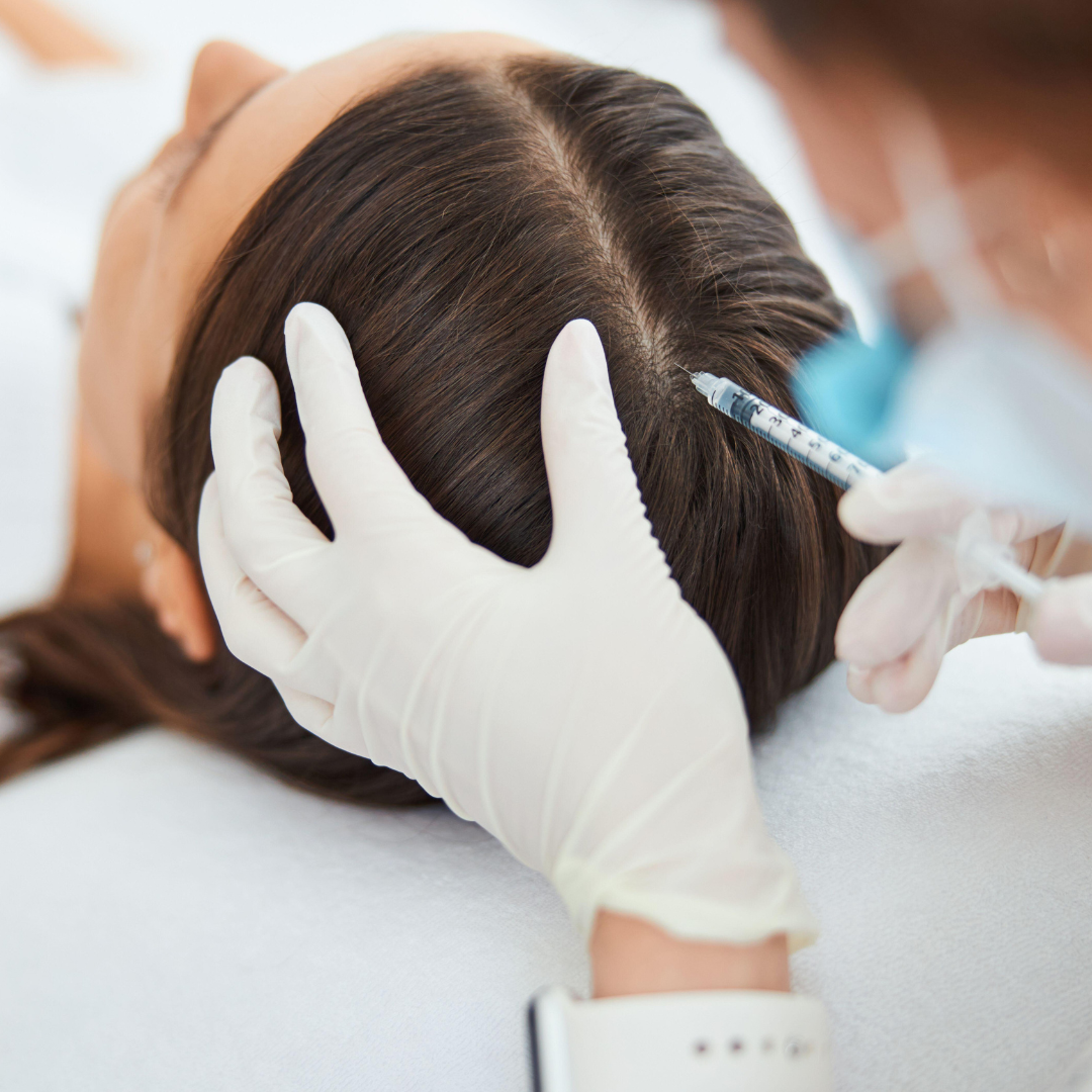 Mesotherapy for Hair Loss