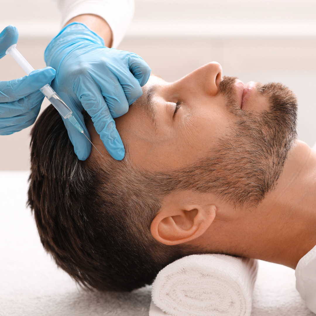 PRP Hair Loss Treatment