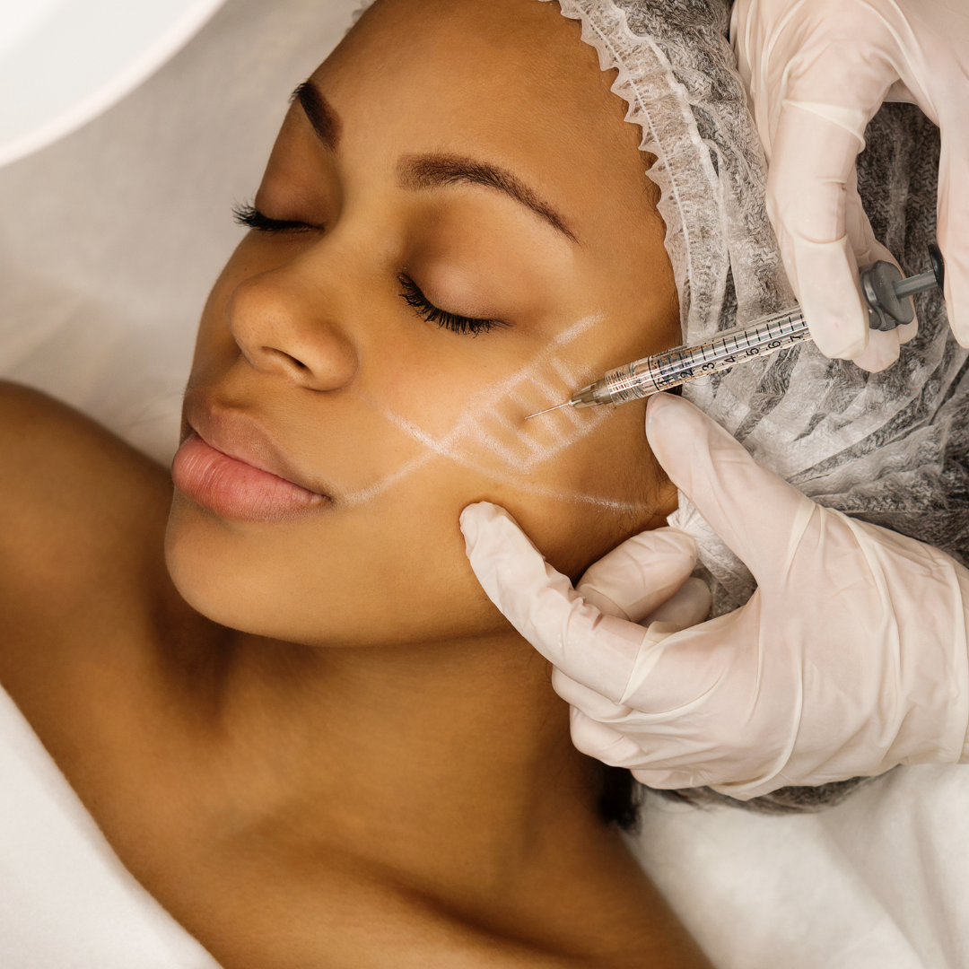 Dermal Filler Treatment