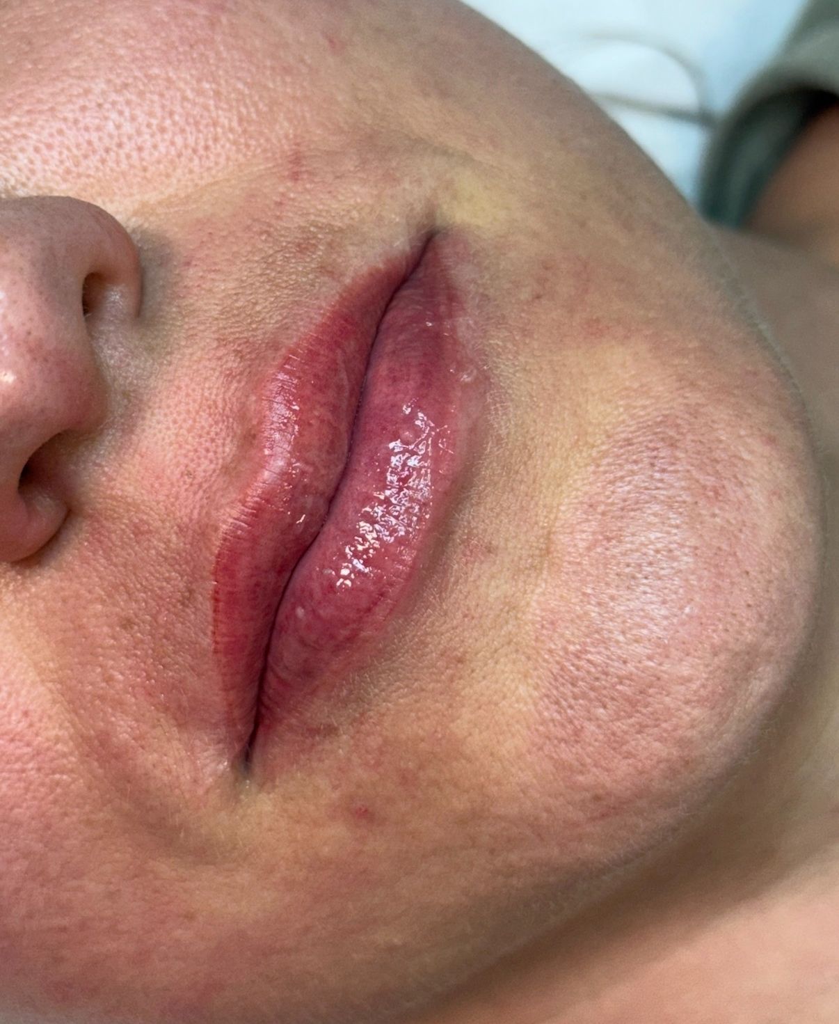 Lips After