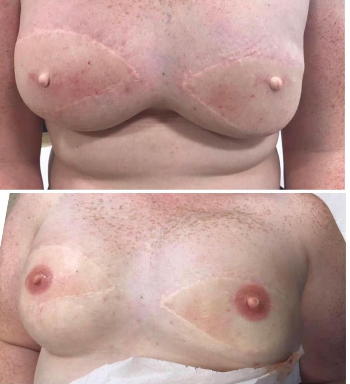 Restoration Result