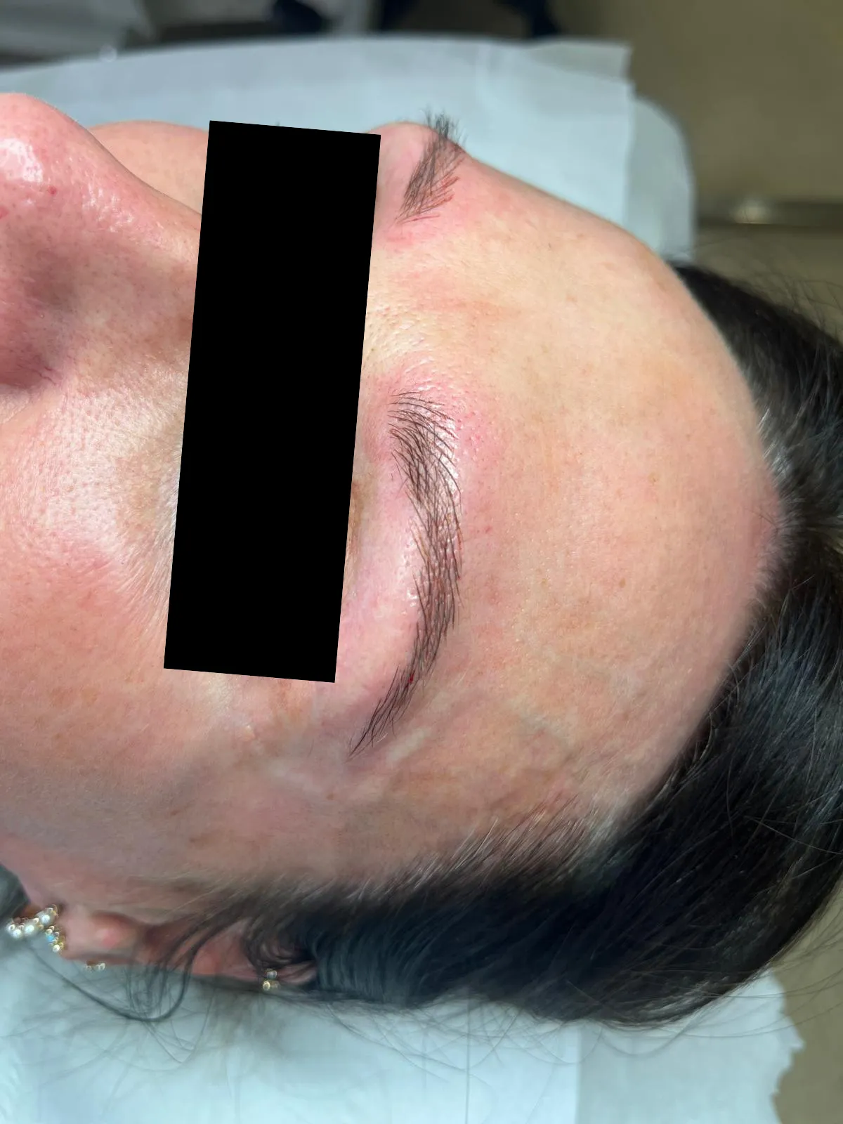 Brows After