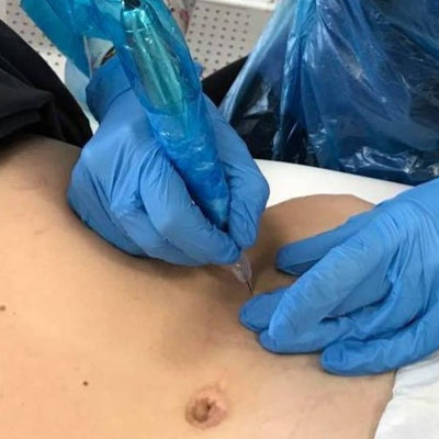 Medical Tattooing