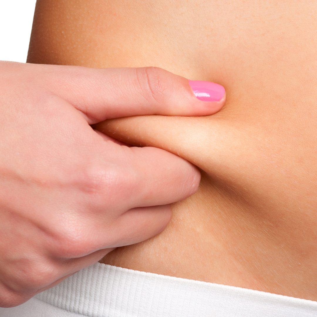 Fat Dissolving Injections