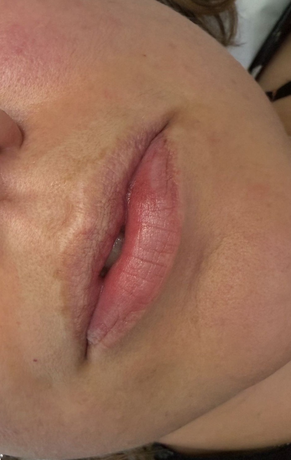 Lips Before