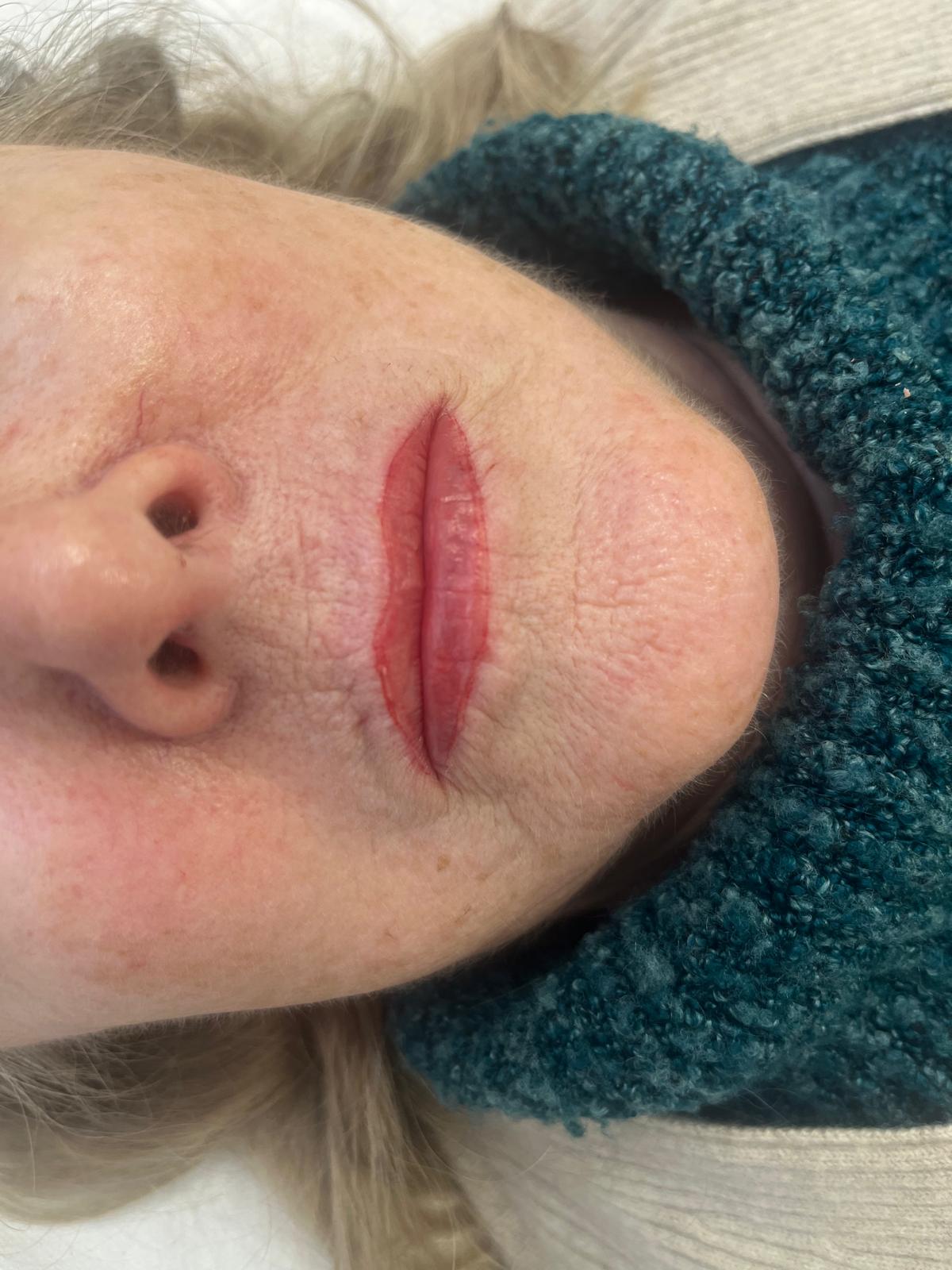 Lips After