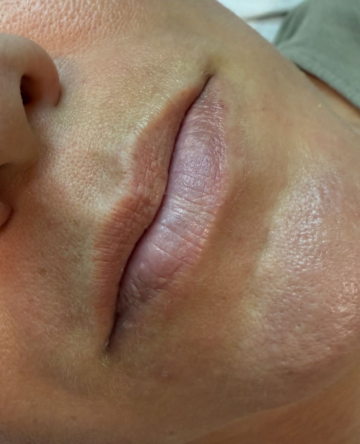 Lips Before