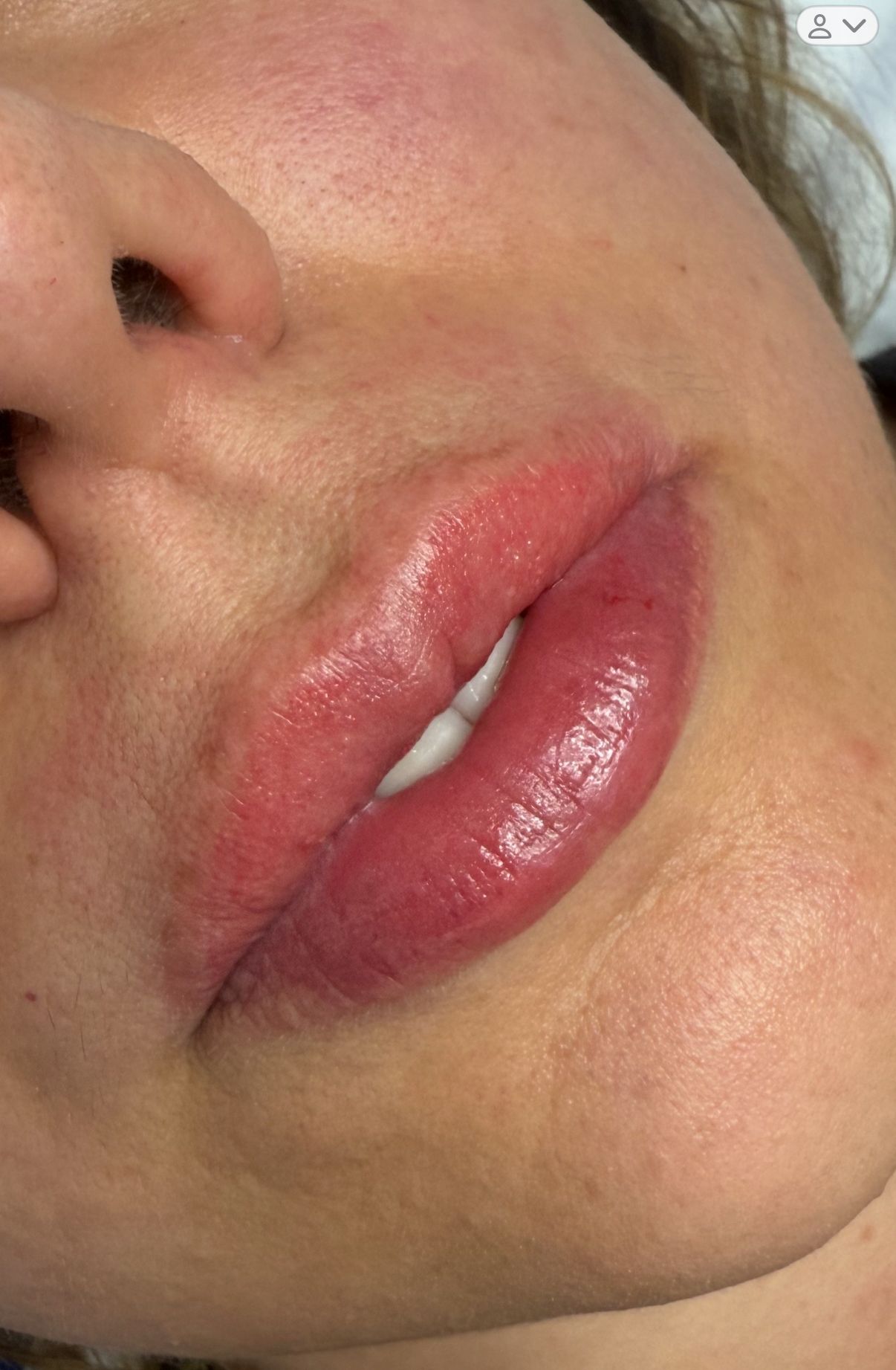 Lips After