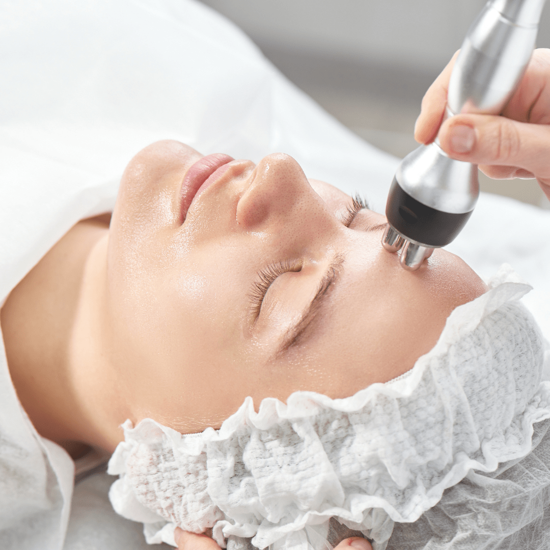 RF Skin Tightening