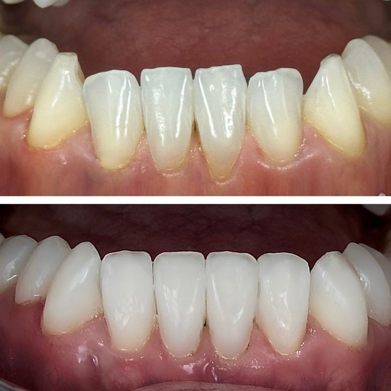 Before and After 21