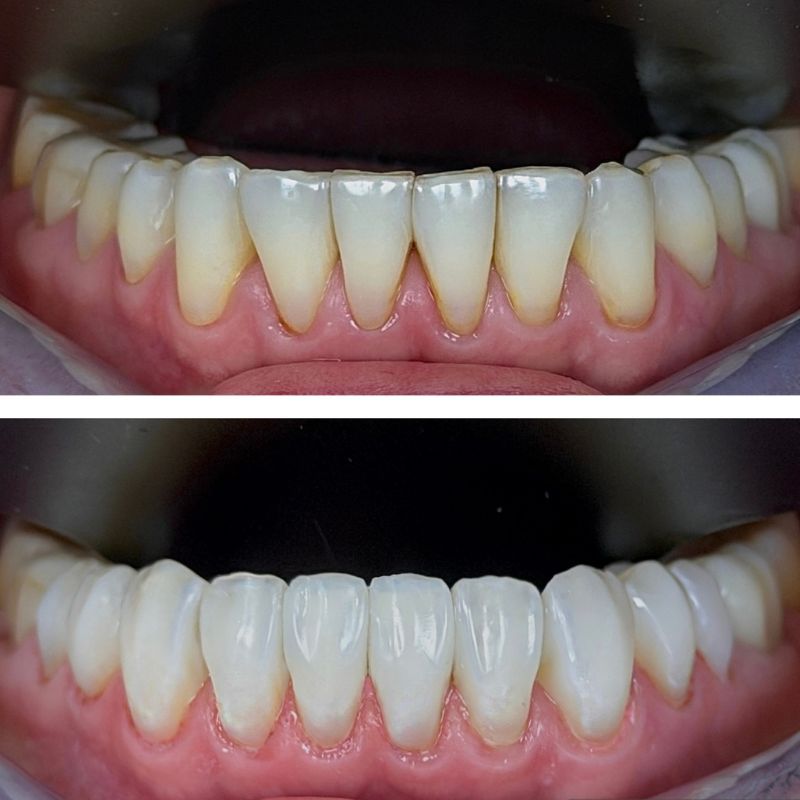 Before and After 5