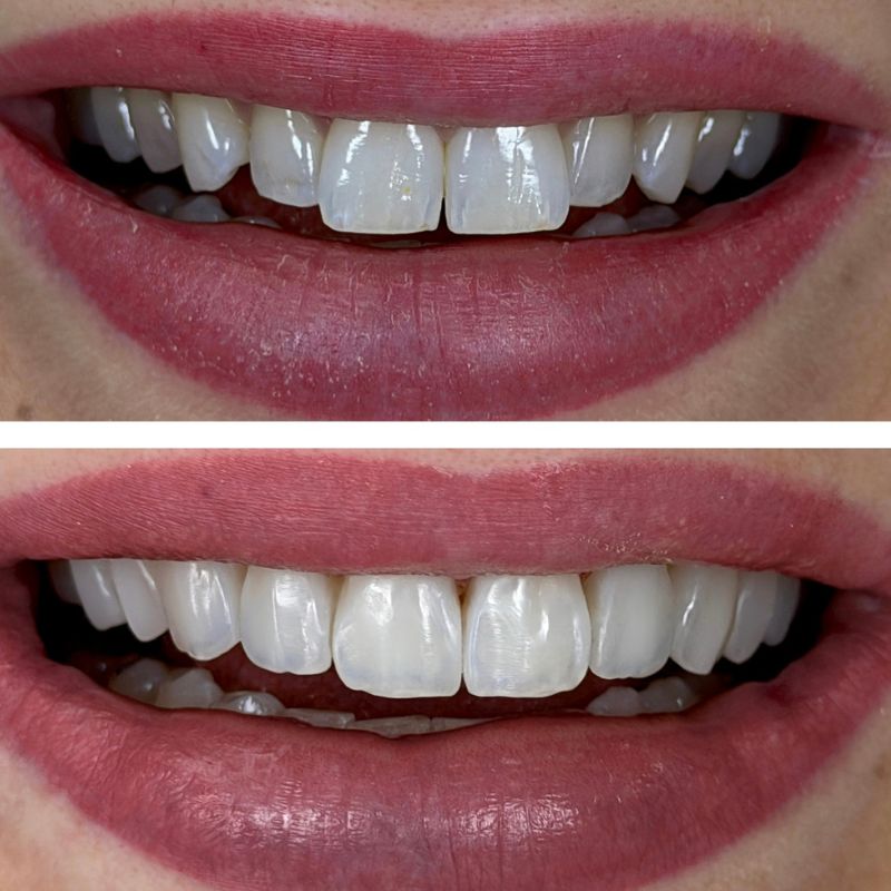 Before and After 20